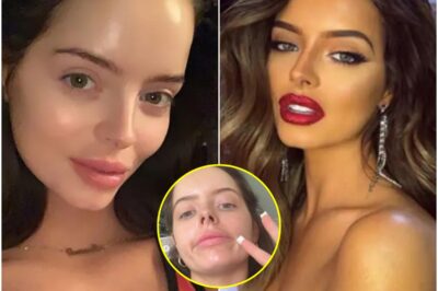 “IT’S K!LLING ME!”: Maura Higgins begs fans for hel, Left in “Excruciating Pain” After Mysterious Injury .K